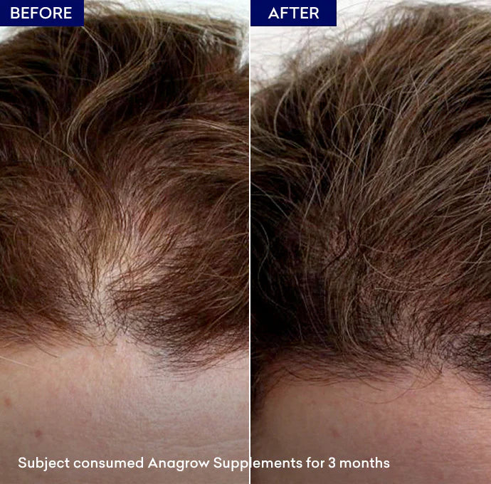 Anagrow Soft Gel Capsules