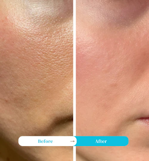 Eventone C Tablets ( Body whitening & Minimizes fine lines, wrinkles, and pores )