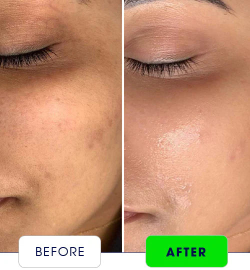 Maxdif G Anti-Aging | Boosts Immunity