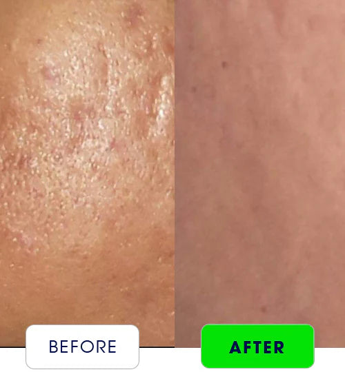 Maxdif G Anti-Aging | Boosts Immunity